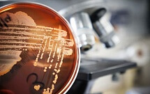 Микробиологические (бактериологические) исследования