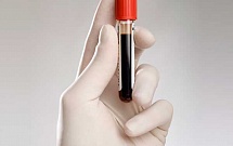 где можно сдать анализ биохимия крови