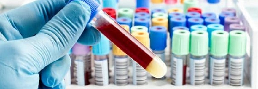 Анализ биохимии крови: что входит в анализ крови
